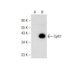 Cyr61/CCN1 Antibody (A-10) - Western Blotting - Image 148809