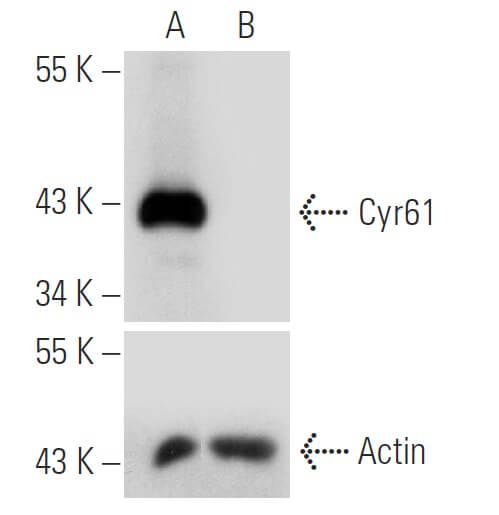 Cyr61 CCN1 siRNA h shRNA and Lentiviral Particle Gene Silencers