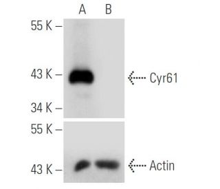Cyr61 shRNA Plasmid (h): sc-39331-SH. Western blot analysis of human Cyr61 expression in Cyr61 transfected (A) and Cyr61/C 