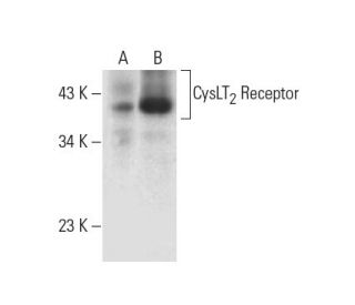 CysLT<sub>2</sub> Receptor Antibody (B-7) - Western Blotting - Image 317971 