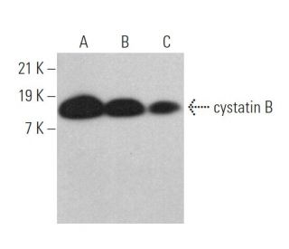cystatin B Antibody (6D332) - Western Blotting - Image 372928 