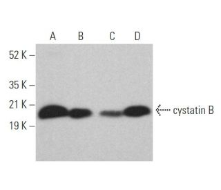cystatin B Antibody (RJMW 2E7) - Western Blotting - Image 372927 