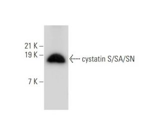 cystatin S/SA/SN Antibody (Z8983) - Western Blotting - Image 333861SAM Transcription Activation: SAM system utilizing dCas9-VP64, MS2-P65-HSF1, and sgRNA for precise gene transcription activation. 