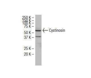 Cystinosin Antibody (F-12) - Western Blotting - Image 34073