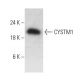 CYSTM1 Antibody (1-RE17) - Western Blotting - Image 385154 