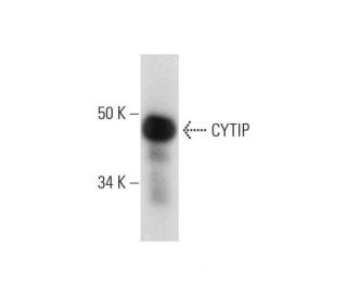 CYTIP Antibody (H-6) - Western Blotting - Image 290843 