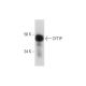 CYTIP Antibody (H-6) - Western Blotting - Image 290843 