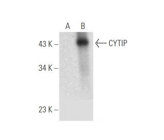 CYTIP Antibody (B-3) - Western Blotting - Image 333370Each CRISPR/Cas9 Knockout (KO) Plasmid product consists of a pool of 3 plasmids designed to ensure identification and cleavage of a specific gene for maximum knockout efficiency. Each plasmid encodes a unique 20 nt sequence derived from the GeCKO (v2) library.