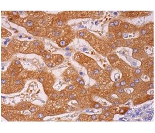 immunohistochemistry image from recommended cytochrome b5 (36) monoclonal antibody replacement. Image 293661