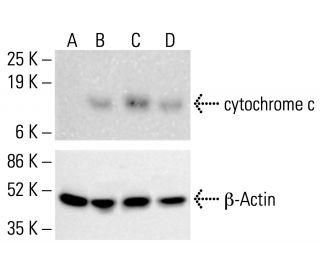 洋楽 CYTOTOXIN Amazon.com: Biotics Research Cytozyme B Supports Brain Health. Raw