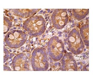 immunohistochemistry image from recommended cytoglobin (D-7) monoclonal antibody replacement. Image 160281