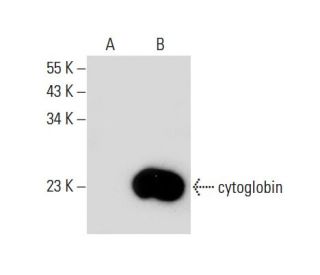 cytoglobin Antibody (G-2) - Western Blotting - Image 138573Each CRISPR/Cas9 Knockout (KO) Plasmid product consists of a pool of 3 plasmids designed to ensure identification and cleavage of a specific gene for maximum knockout efficiency. Each plasmid encodes a unique 20 nt sequence derived from the GeCKO (v2) library.