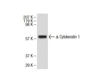Cytokeratin 1 Antibody (4D12B3) - Western Blotting - Image 137430 