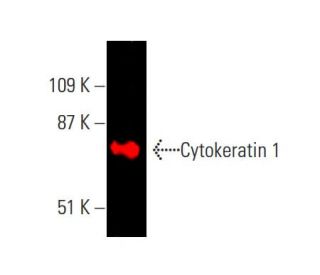 Cytokeratin 1 Antibody (E-12) - Western Blotting - Image 382009 