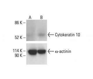 Cytokeratin 10 Antibody (4A27) - Western Blotting - Image 412171