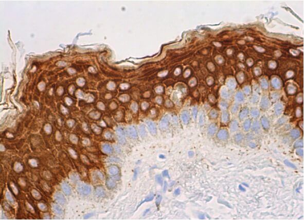 Cytokeratin 10 Antibody (RKSE60) | SCBT - Santa Cruz