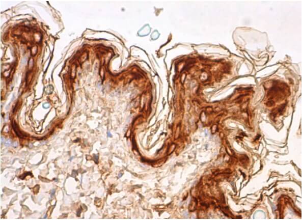 Cytokeratin 10 Antibody (RKSE60) | SCBT - Santa Cruz Cytokeratin 10 Antibody (RKSE60) | SCBT - Santa Cruz