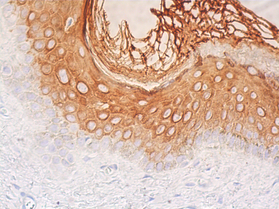 Cytokeratin 10 Antibody (RKSE60) | SCBT - Santa Cruz Cytokeratin 10 Antibody (RKSE60) | SCBT - Santa Cruz