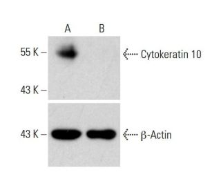 Cytokeratin 10 CRISPR/CAS9 KO Plasmid (h): sc-400193. Western blot analysis of Cytokeratin 10 expression in empty vector cEach CRISPR/Cas9 Knockout (KO) Plasmid product consists of a pool of 3 plasmids designed to ensure identification and cleavage of a specific gene for maximum knockout efficiency. Each plasmid encodes a unique 20 nt sequence derived from the GeCKO (v2) library. 