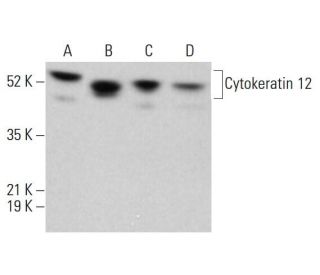 western blotting image from recommended Cytokeratin 12 (E-8) monoclonal antibody replacement. Image 380344