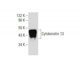 Cytokeratin 13 Antibody (Ks13.1) - Western Blotting - Image 62204