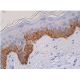 immunohistochemistry image from recommended Cytokeratin 14 (LL001) monoclonal antibody replacement. Image 361375