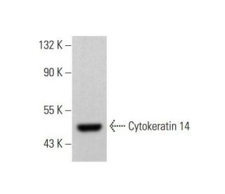 Cytokeratin 14 Antibody (LL001) - Western Blotting - Image 353242