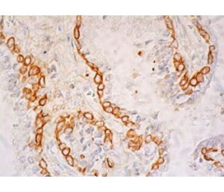 Cytokeratin 15 Antibody (LHK15) | SCBT - Santa Cruz