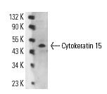 Cytokeratin 15 Antibody (LHK15) | SCBT - Santa Cruz