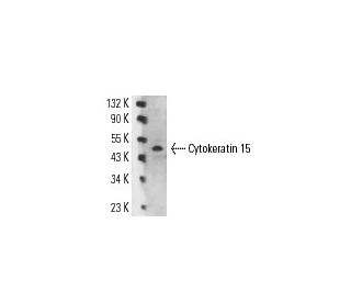 Cytokeratin 15 Antibody (LHK15) - Western Blotting - Image 14543The Double Nickase Plasmid features a U6 promoter for sgRNA expression, a 20 nt targeting sequence, and a gRNA scaffold to guide Cas9n. It includes a CBh promoter for Cas9n (D10A) and puromycin resistance, GFP for transfection verification, and nuclear localization signals (NLS). The 2A peptide allows co-expression of Cas9n and Puro from a single promoter, enabling precise genome editing with reduced off-target effects. 