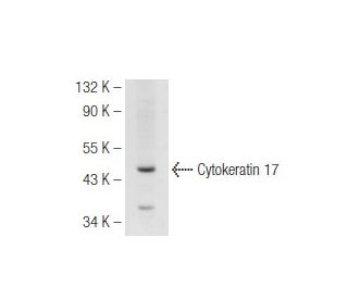 Cytokeratin 17 Antibody (Ks17.E3) - Western Blotting - Image 93609