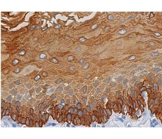 Cytokeratin 18 Antibody (B-6) | SCBT - Santa Cruz Biotechnology