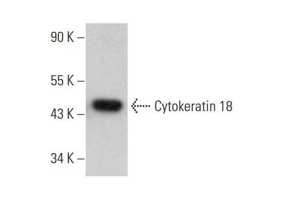 Cytokeratin 18 Antibody (B-6) | SCBT - Santa Cruz Biotechnology