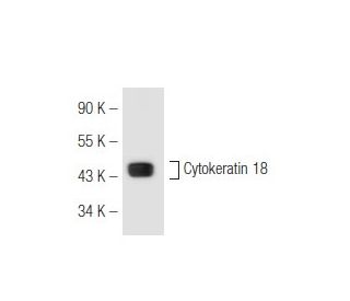 western blotting image from recommended Cytokeratin 18 (RGE53) monoclonal antibody replacement. Image 49729