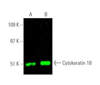 Cytokeratin 18 Antibody (RGE53) - Western Blotting - Image 375683 
