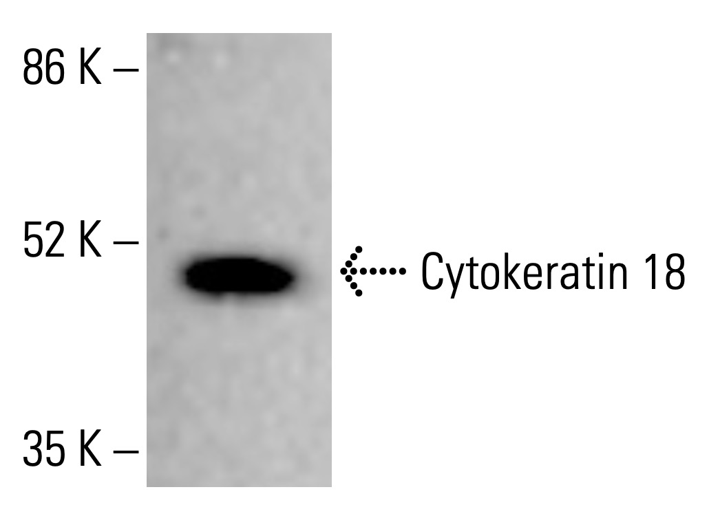 洋楽 CYTOTOXIN Cytokeratin 18 Antibody (810811) [Alexa Fluor® 488] (IC7619G