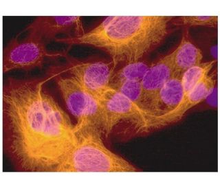 健康・医学 Receptor Based Solutions On-demand treatment of metabolic diseases by a synthetic