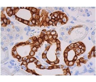 Cytokeratin 19抗体(A-3) | SCBT - Santa Cruz Biotechnology