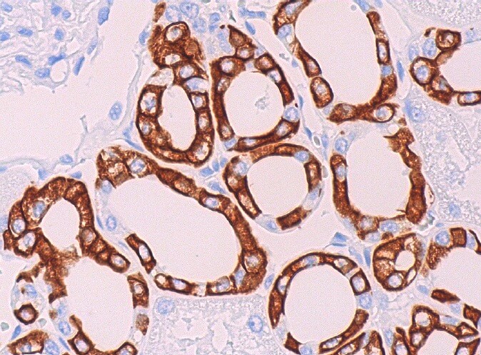 健康・医学 Receptor Based Solutions Cytokeratin 19抗体(A-3) | SCBT - Santa Cruz Biotechnology