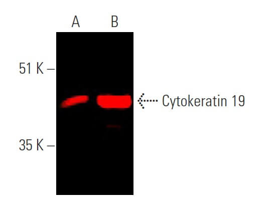 健康・医学 Receptor Based Solutions Cytokeratin 19抗体(A-3) | SCBT - Santa Cruz Biotechnology