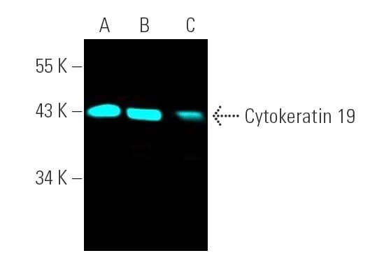 Cytokeratin 19抗体(A-3) | SCBT - Santa Cruz Biotechnology