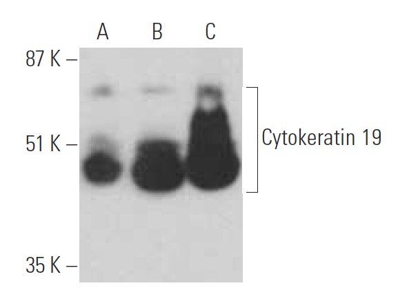 健康・医学 Receptor Based Solutions On-demand treatment of metabolic diseases by a synthetic