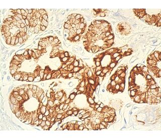 洋楽 CYTOTOXIN Cytokeratin 18 Antibody (810811) [Alexa Fluor® 488] (IC7619G
