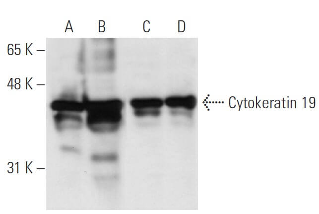 洋楽 CYTOTOXIN Anti-cytokeratin 19 antibody [EP1580Y] - cytoskeleton marker