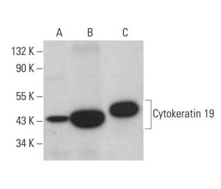 Cytokeratin 19 Antibody (F-6) - Western Blotting - Image 376120 