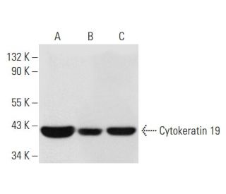 western blotting image from recommended Cytokeratin 19 (A-3) monoclonal antibody replacement. Image 294563