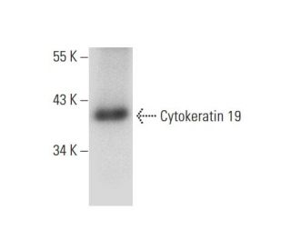 Cytokeratin 19 Antibody (A-3) - Western Blotting - Image 303364 