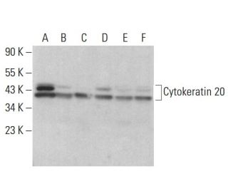 Cytokeratin 20 Antibody (E-9) - Western Blotting - Image 381323 