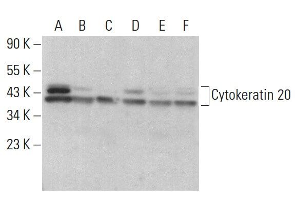 cytokeratin-20-antibody-e-9-