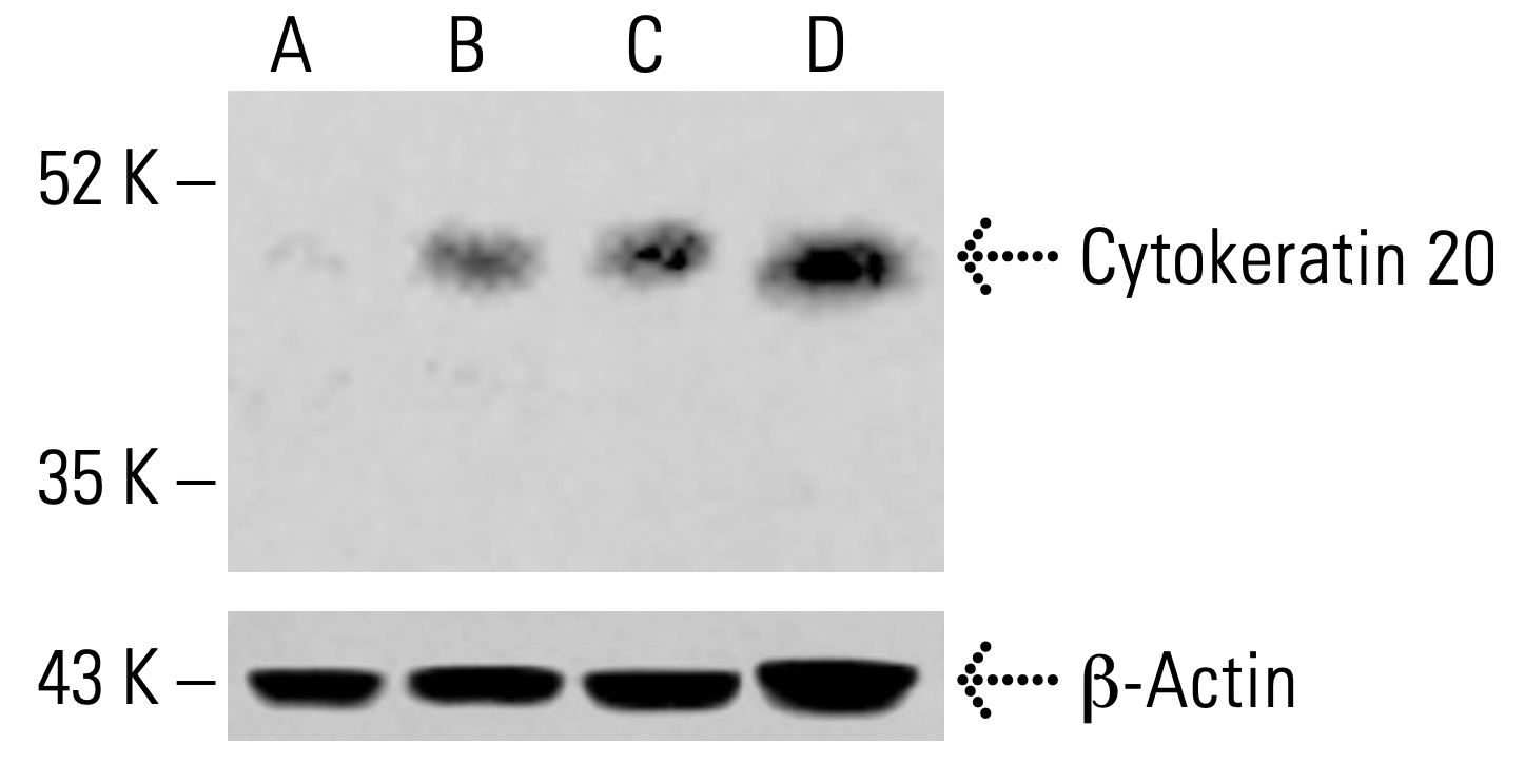 Cytokeratin 20 Antibody (E-9) | SCBT - Santa Cruz Biotechnology
